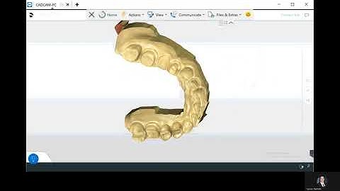 Primescan connect steps