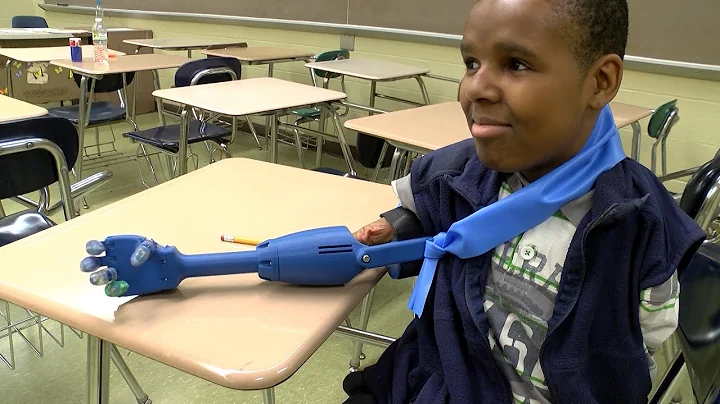 Cleveland teachers use 3D printer to make prosthetic for student with no arms