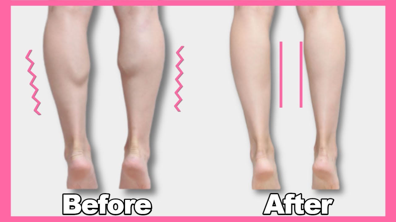 종아리 얇아지는 스트레칭 ! [이것을 모르면 당신의 종아리는 더 두꺼워집니다] 종아리 스트레칭, 종아리 알 빼기, 종아리 살이 안빠지는 이유