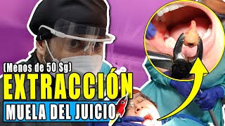 [Video en VIVO]  Extracción de    sin cirugia ( en SOLO 50SG y SIN DOLOR)