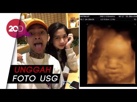 7 Keputihan Bulan Hamil