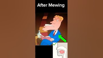 Mewing Transformation 🤫🧏‍♂️ #mewing #looksmaxxing #memes #mogger #shorts