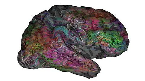 Scientists Discover Human Brain Is a Living Word Cloud - DayDayNews