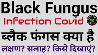 Black fungus kya hai | black fungus ki bimari | black fungus se kaise bache |black fungus ke lakshan