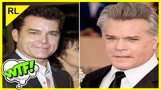 20 Famosos antes y después de la cirujias estéticas plásticas !