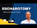 Escharotomy - What is it, and how is it done?