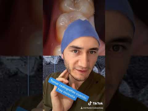 Видео: Radiografía Dental