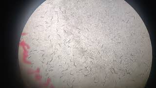 C elegans under Microscope