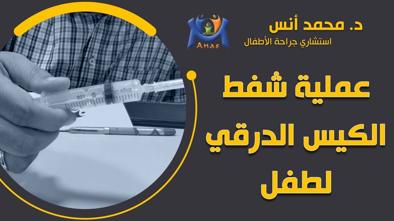 عملية شفط الكيس الدرقي لطفل / #دكتور_محمد_أنس