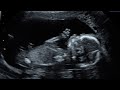 16 WEEK ULTRASOUND WITH HEARTBEAT / 4D sneak peak & Gender reveal