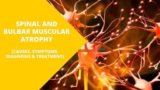 Spinal and Bulbar Muscular Atrophy: Breaking Down the Science Behind the Disease