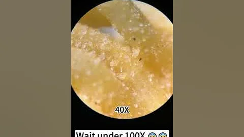 The Hidden World of Instant Noodles: A Microscopic View #noodles #explore #instantrecipe #noodle