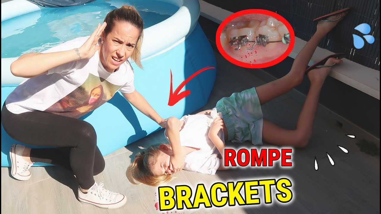 DANIELA SE CAE EN LA PISCINA Y ROMPE LOS BRACKETS 😱 MI HIJA SE GOLPEA EN LA PILETA / Doble Twins