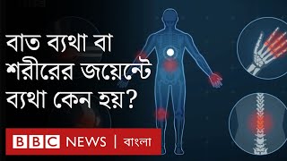 Arthritis: হাঁটু বা শরীরের জয়েন্টে ব্যথা বা বাত ব্যথা কেন হয়? লক্ষণ কী? এরকম ব্যথা কমানোর উপায় কী?