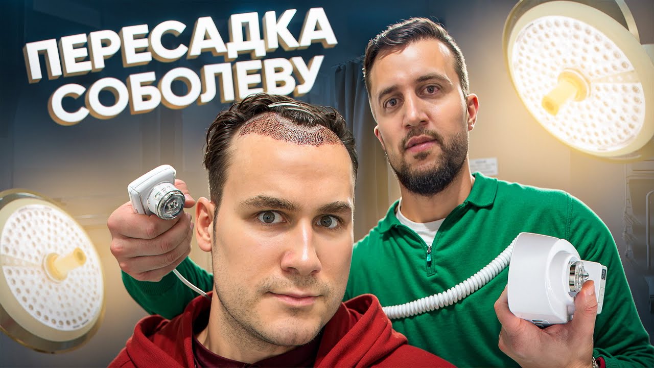 ПЕРЕСАДКА ВОЛОС НИКОЛАЮ СОБОЛЕВУ