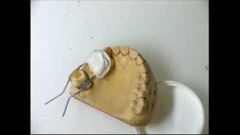 How to solder band and loop  space maintainer