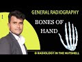 Hand bones explanation || Radiology || Hand bone anatomy || Radiology in the nutshell || Carpal ||