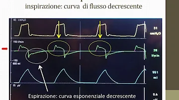 Cos'è un sistema di ventilazione meccanica controllata?