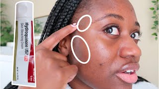CAN HYDROQUINONE FADE HYPERPIGMENTATION? 🤔 | 3 MONTHS USING 4% HYDROQUINONE by benenon 38,417 views 1 year ago 9 minutes, 25 seconds