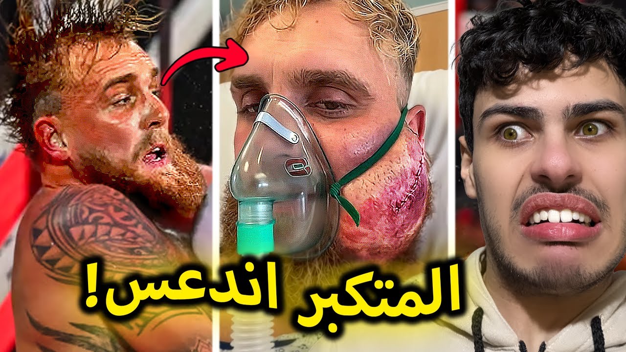 اندعس بعدما اتكبر على نص خلق الله 🤣