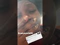 @teraDelarosa-y1g Now I know I need surgery because I’m so YUCK 🤮 😭 Thanks for your support.