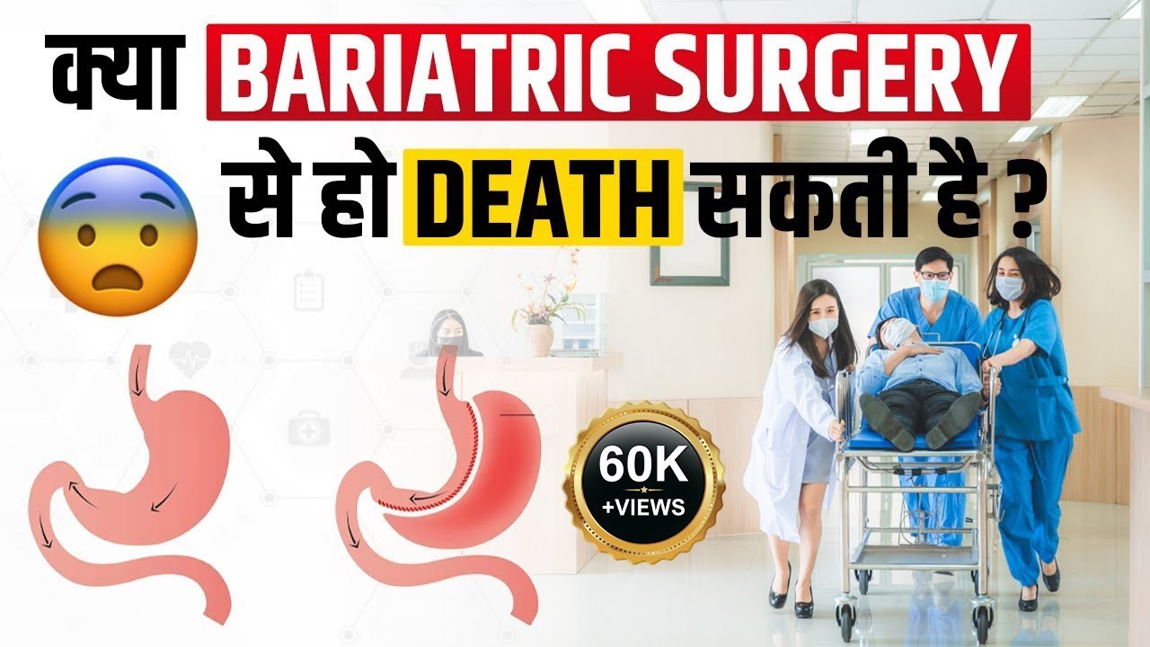 Side Effects of Bariatric Surgery  Listen this before Weight Loss Surgery  Death after Surgery