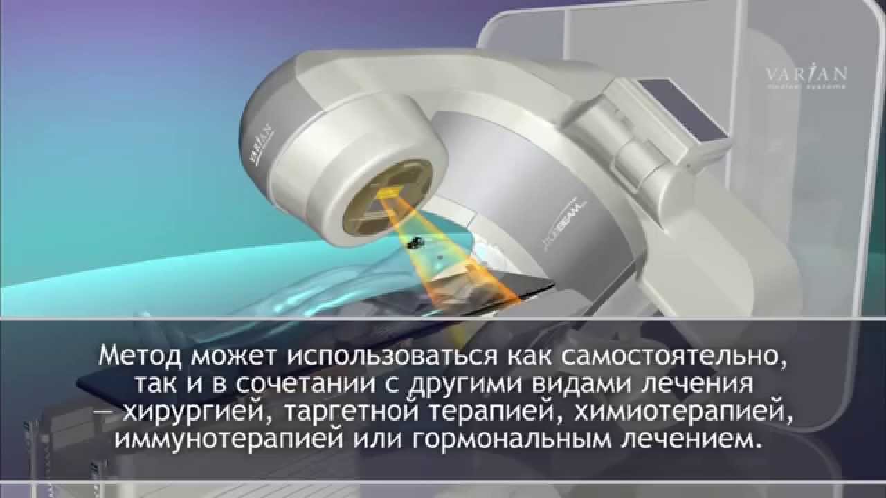 МИБС Санкт Петербург (с титрами) - YouTube
