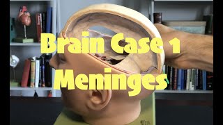 Brain Case 1 Cranial Meninges