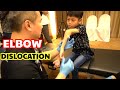 Top 5 Most Special Case Elbow Dislocation