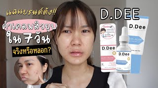 แฉแบรนด์ดัง D.Dee คำเคลมสิวยุบใน 7 วัน จริงหรือหลอก? รีวิวคนอื่นว่าดีแต่ใช้จริง… | This is Pear