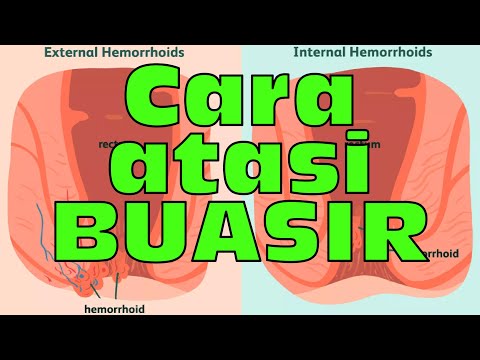 BUASIR, cara natural untuk mengatasinya — Dr. Noordin Darus