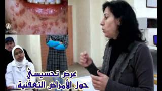 collège ibn achirعرض الأمراض المنقولة جنسيا 2013