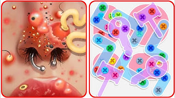 Screw Match ASMR Story All Levels 1-20 Game Answers Walkthrough Gameplay Solution