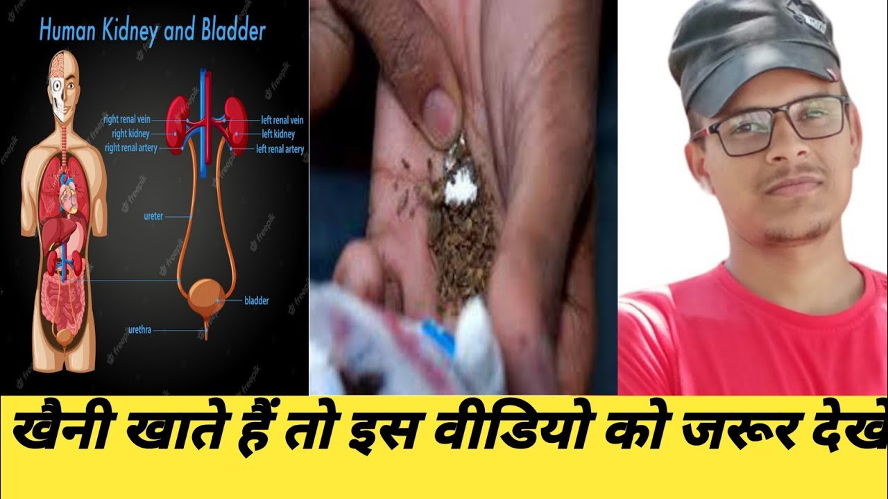 Kumar Helper खैनी खाने के एक अद्भुत फायदे किडनी पर। Real Life Experience। By Sonu ...