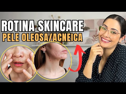 Rotina de Skincare para Pele Oleosa e com Acne: Passo a Passo e Produtos Recomendados!