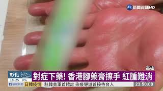 藥別亂擦! 手癢擦香港腳藥反紅腫起泡| 華視新聞20200226 