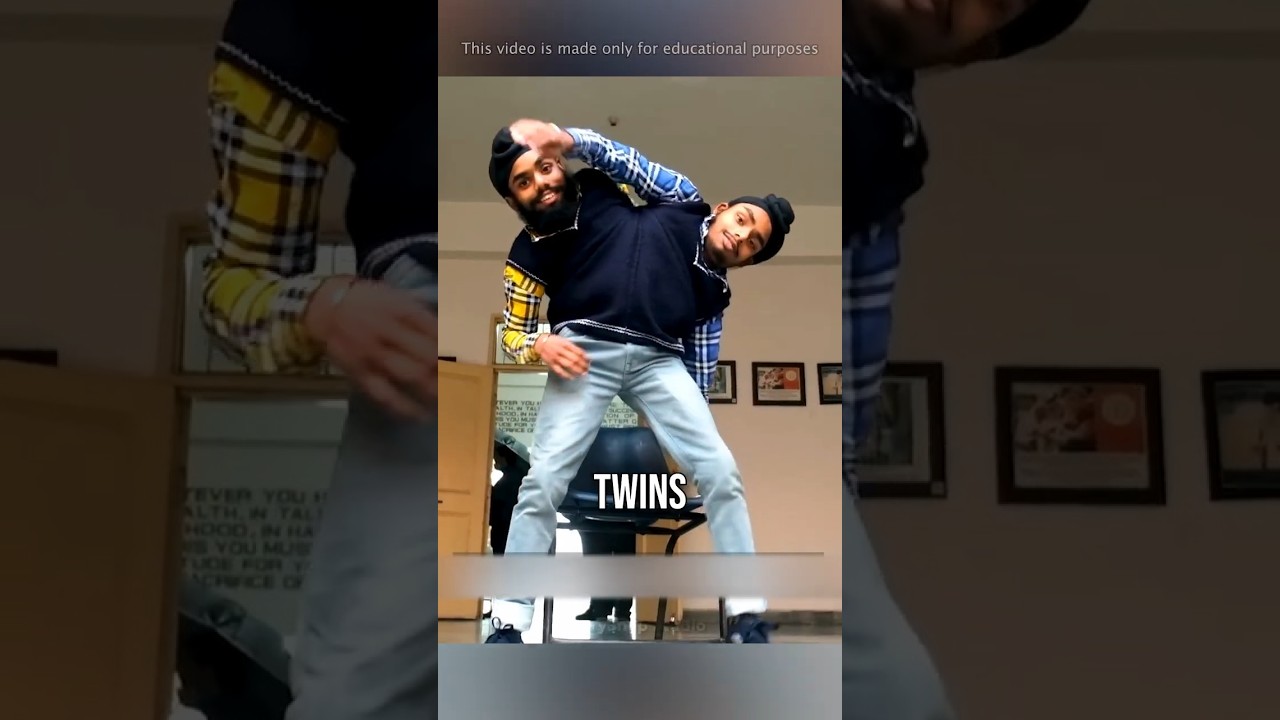 Самые уникальные сиамские близнецы в истории человечества 😳