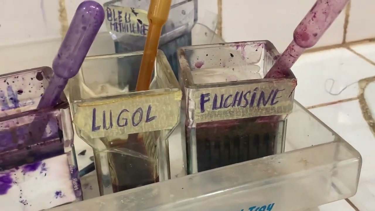 Prélèvement vaginal