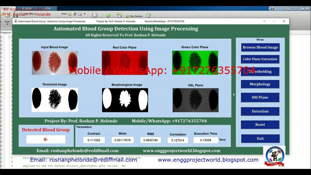 Blood Group Detection Using Image Processing With Source Code Matlab ...