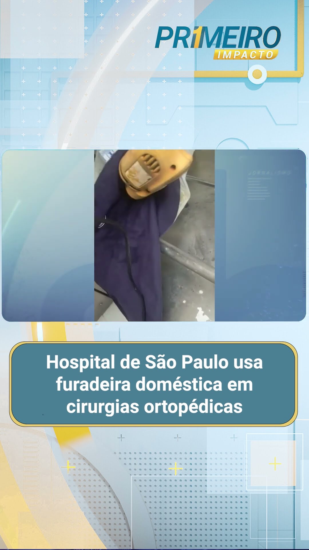 Hospital de São Paulo usa furadeira doméstica em cirurgias ortopédicas