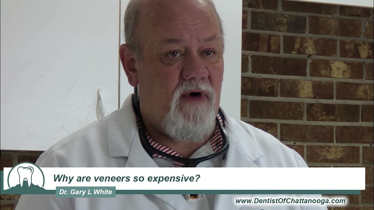 Why are veneers so expensive? YouTube