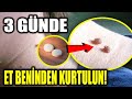 3 Günde Et Benlerinden Tamamen kurtulun! Aspirin Mucizesi!