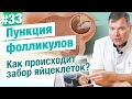 Пункция фолликулов Как происходит забор яйцеклеток при ЭКО? Сколько времени занимает процедура?