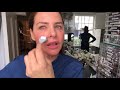 Micro needling - The lowdown   |Trinny London