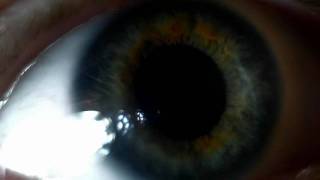 eye contact - 25 march 2010