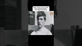 Shocking Changes in Soldiers After WW1