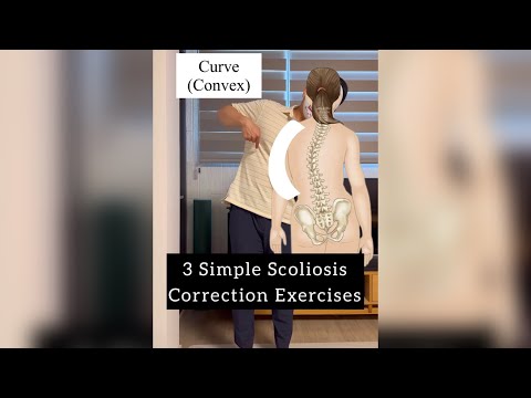 Posture : Scoliosis