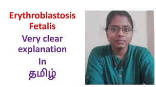 Erythroblastosis Fetalis in Tamil - Very clear explanation ✨