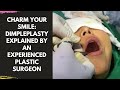 Charm Your Smile: Dimpleplasty Explained by an Experienced Facial Plastic Surgeon