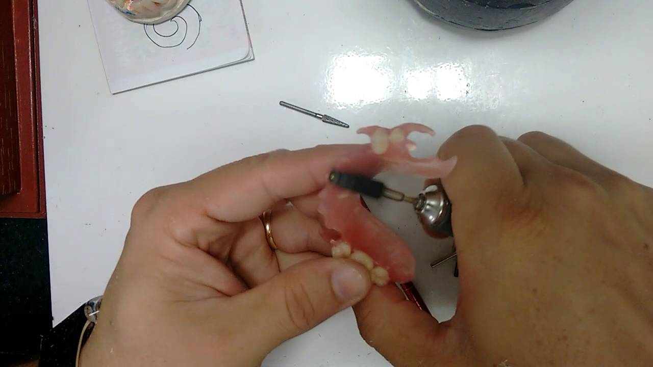 Acabamento em prótese dentária flexível